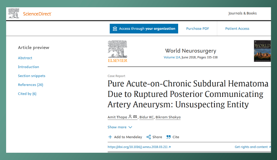 Pure acute on chronic SDH due to ruptured PCOM aneurysm: an unsuspecting entity